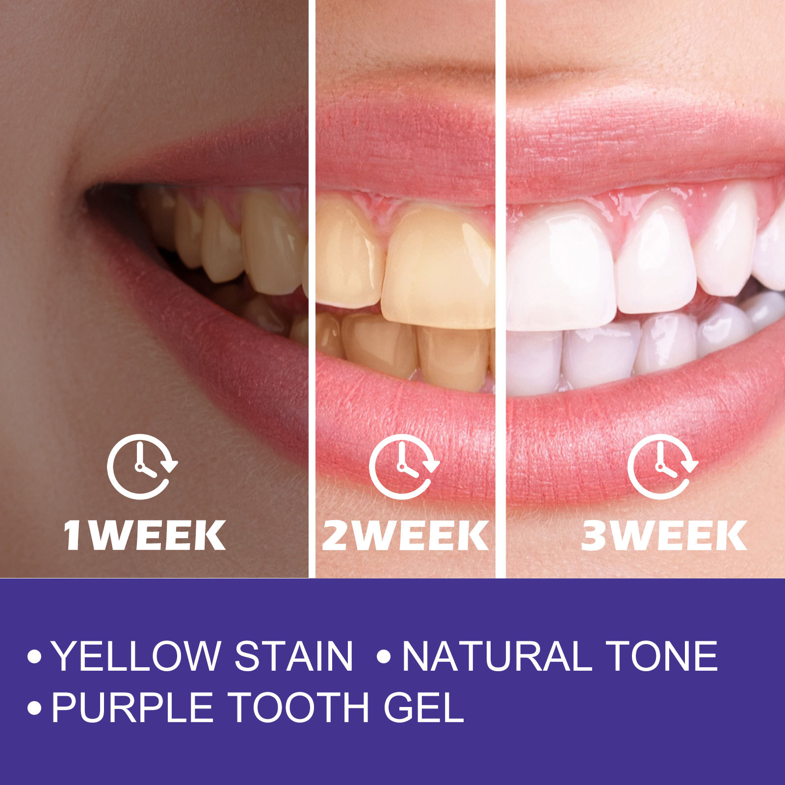 Purple Toothpaste Teeth Whiten - Teeth Whitening Crest review and price