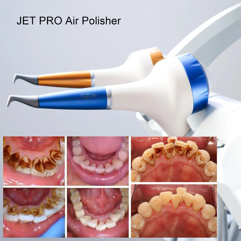 VV Dental  Air Polishing Proph - Teeth Whitening Dental review and price