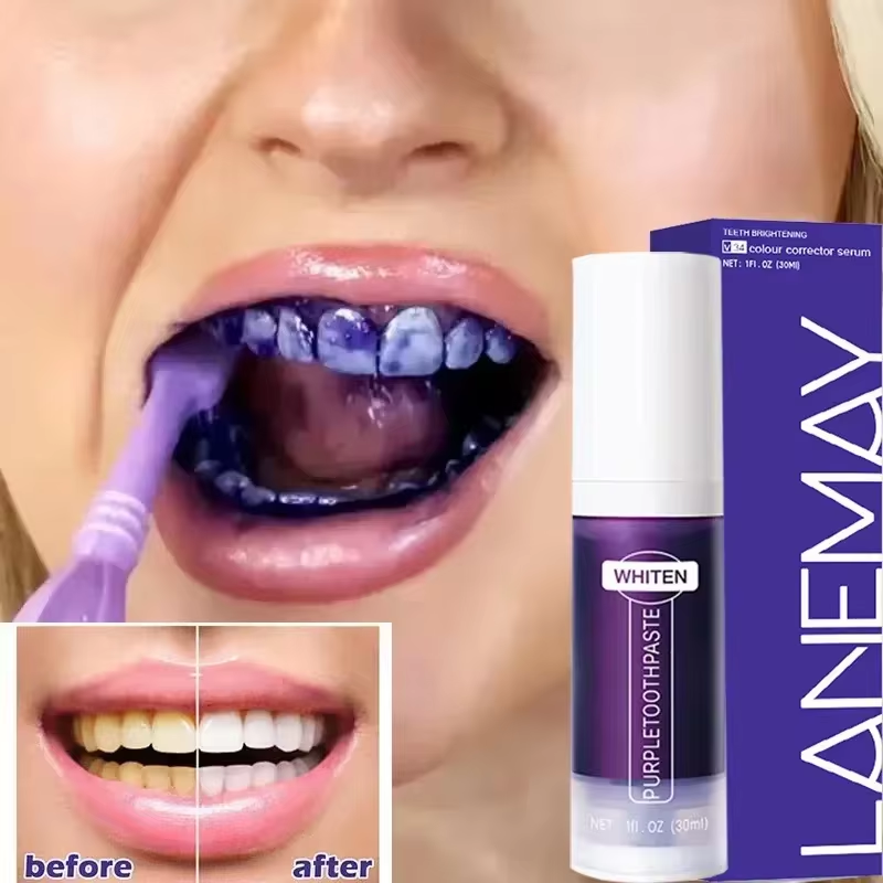 V34 Purple Teeth Whitening Too - Teeth Whitening Crest review and price