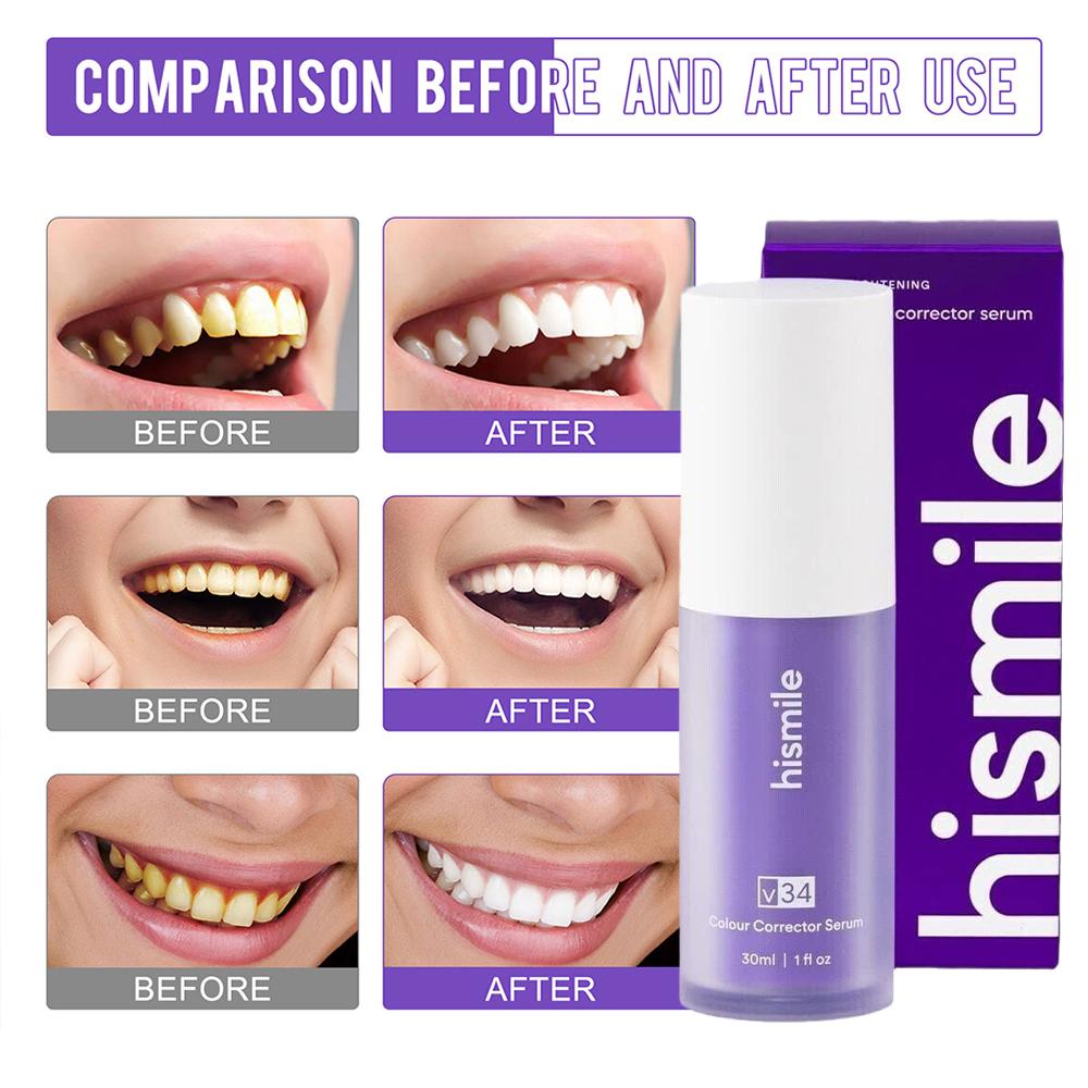 Purple Teeth Whitening Strips  - Teeth Whitening (Bleaching) review and price