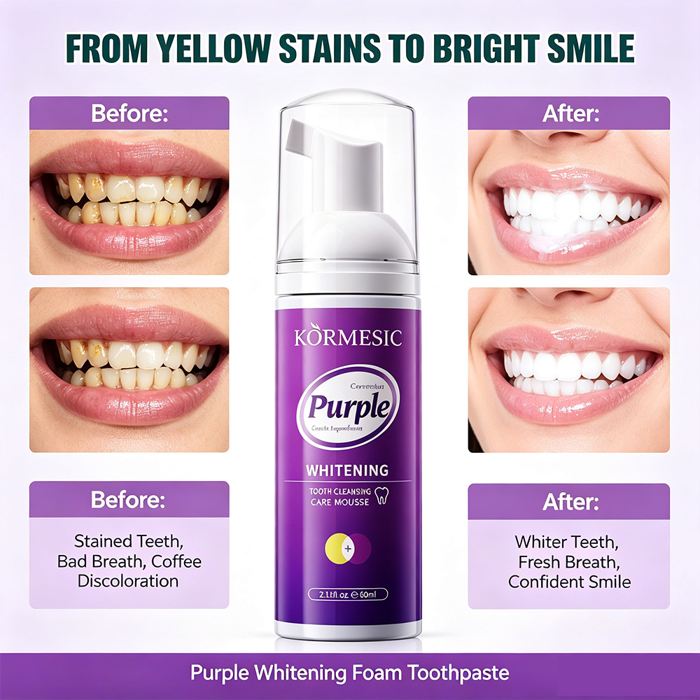 Purple Whitening Tooth Mousse  - Teeth Whitening Crest review and price
